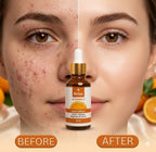 Relax Vitamin C Brightening Serum (30ml)